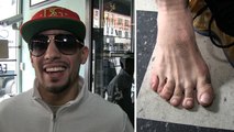 Boxer Danny Garcia -- I'VE GOT 6 TOES ... This Little Piggy Gives Me a Huge Advantage!