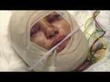 AVANT, PENDANT ou APRÈS?: Kellie Maloney est presque morte après avoir voulu des yeux plus féminin