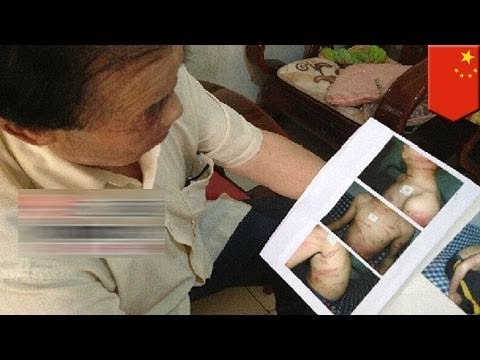 Жестокое обращение или экстремальное воспитание? Мать избила сына, не сделавшего домашнее задание