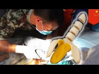 Пенис застрял в трубе на два дня