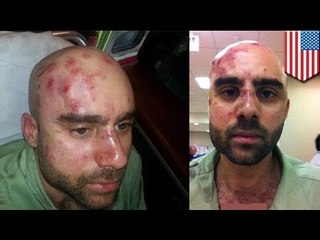 Профессора университета жестоко избили за плохую оценку