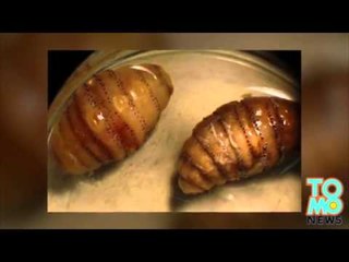 BEURK!!: Un homme revient de voyage avec 20 asticots sous sa peau