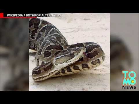 QUOI DE NEUF DOC?: La morsure d’un serpent a coûté la jambe d’une fillette de 13 ans