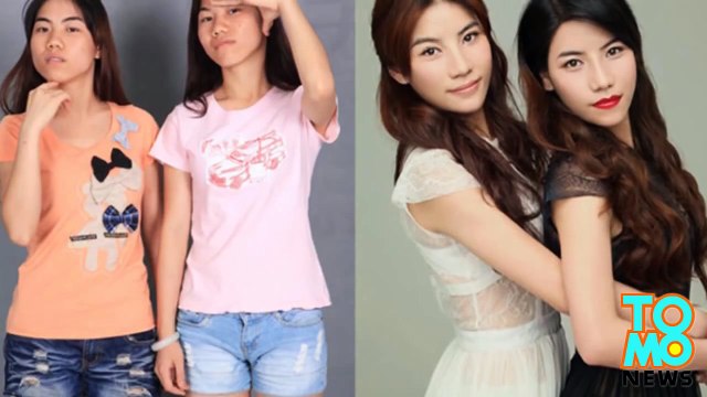 عمليات التجميل وصور لما قبل وبعد عمليات شد البشرة وتشذيب الأنف ونفخ الشفاه