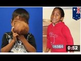 QUOI DE NEUF DOC: Un enfant de 7 ans se fait enlever une massive hernie du cerveau