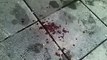 Oslo Explosion 22.07.2011 - Blood on the streets