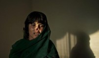 Kocası Tarafından Burnu Kesilen Afgan Kadın Yeni Burnuna Kavuştu