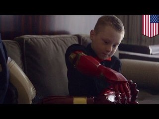 右手ない少年に「アイアンマン」が3D出力の義手を贈呈