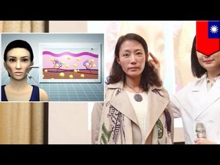 窪み治すため脂肪注入した女性の顔凸凹に…ナゼ？