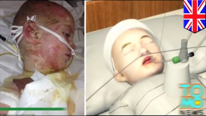 وباء نادر يصيب فتاً في جلده فيقشر معظم الجلد وبالكاد يظل الطفل حياً