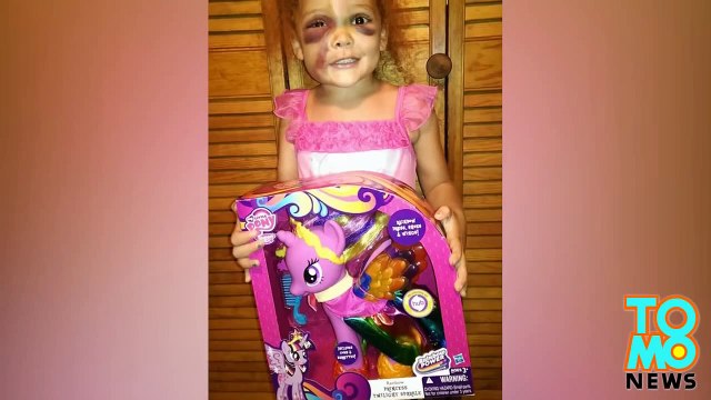 روضة أطفال تدعي أن جروح مريبة أصابت طفلة مجرد حادث