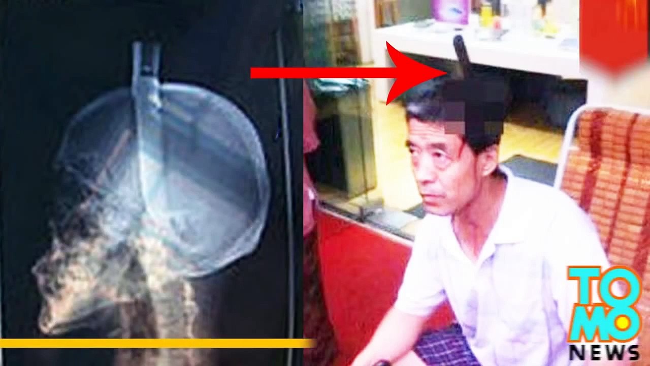 سكين يسقط ويستقر في رأس صيني في شارع غانغيوان