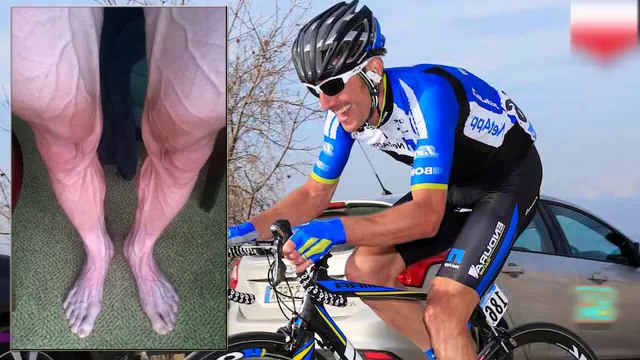 بارتوس هوزراسكي متهم بتعاطي المنشطات بسبب صورة وضعها على فيسبوك تظهر الشرايين بارزة من ساقه