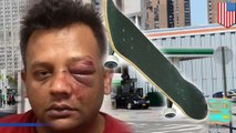 عنصري مخبول يضرب سائق سيارة أجرة بلوح تزحلق في نيويورك