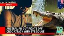 رجل من أستراليايقلع عين تمساح هاجمه
