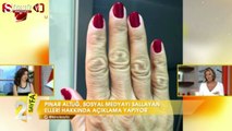 Pınar Altuğ canlı yayında ellerini gösterdi
