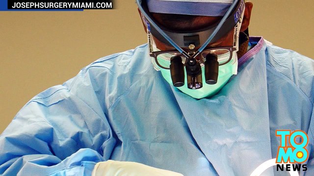 منسق حدائق يولّد انثى غزال بعملية قيصرية مستخدماً مشرط