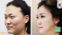 الجراحة التجميلية في كوريا الجنوبية متقنة إلى حد أنك لن تعبر المطار مرة أخرى