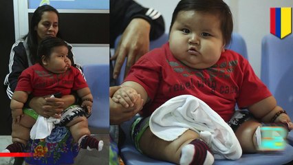 الطفل الأكثر بدانة في العالم