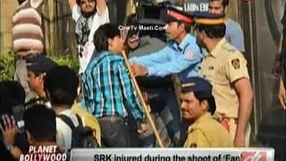 SRK Shoots Despite Injury 11th April CineTv Masti.Com