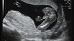 16 weeks Ultrasound - It's a Boy!!!