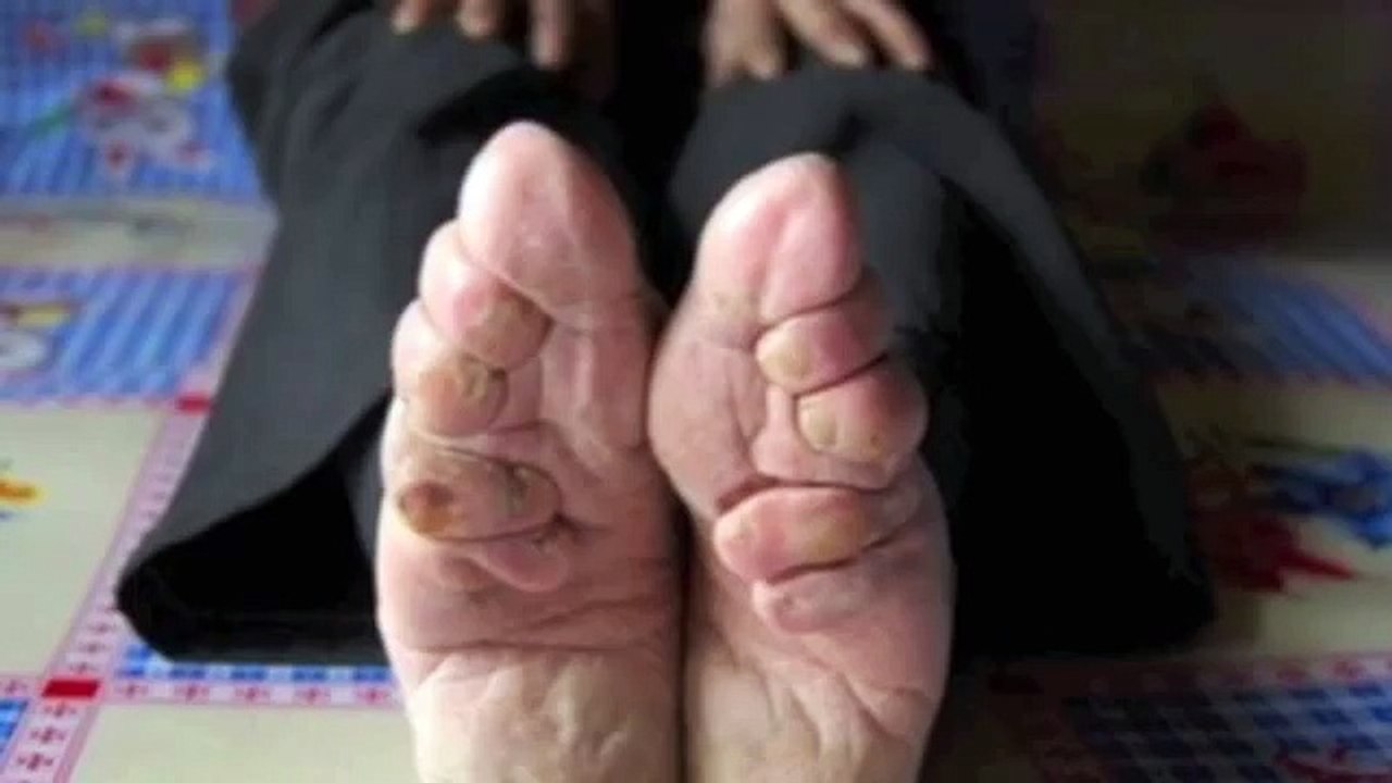 Tradition en Chine des petits pieds ! - Vidéo Dailymotion