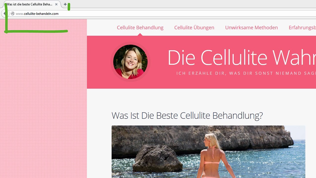 Was hilft gegen Cellulite? Hier die optimale Behandlung finden!