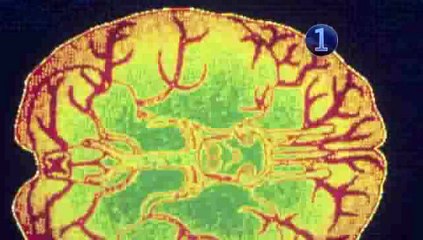 How To Have Better Creative Thinking