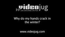 Why do my hands crack in the winter?: Care For Dry And Aging Hands