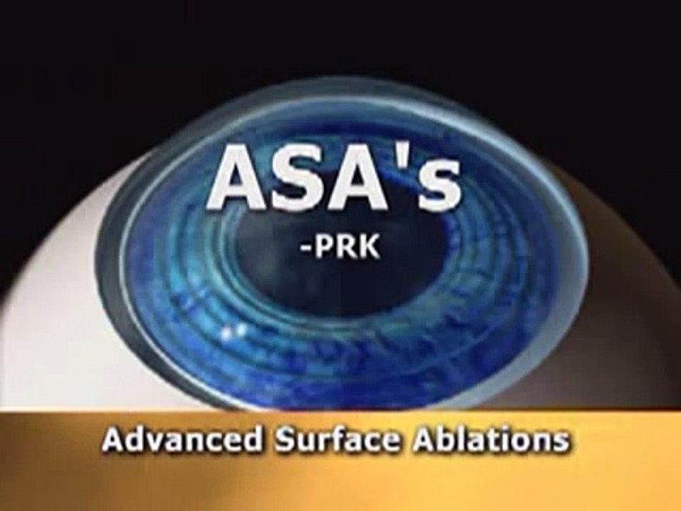 LASIK vs PRK by Dr. Cory Lessner