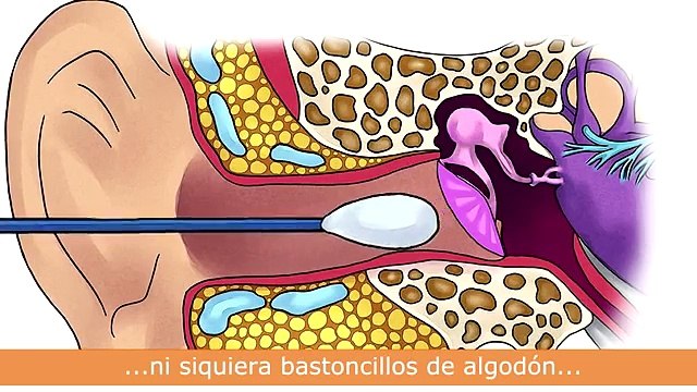 OMS: El Cuidado del oído puede evitar la pérdida auditiva
