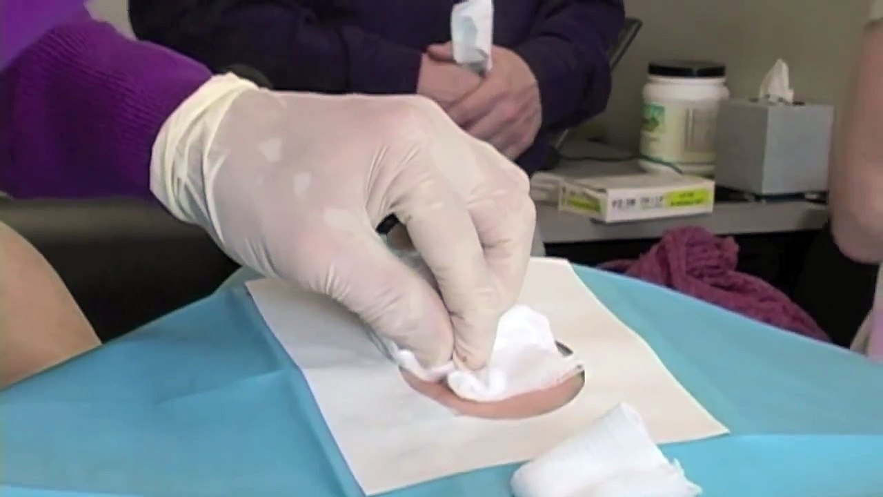 Stem Cell Injection Treatment - Stem Cell Therapy