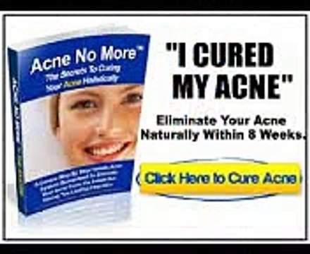 Mike Walden - 12 Michael Walden's Acne No More Reviews - Truly does It Function?