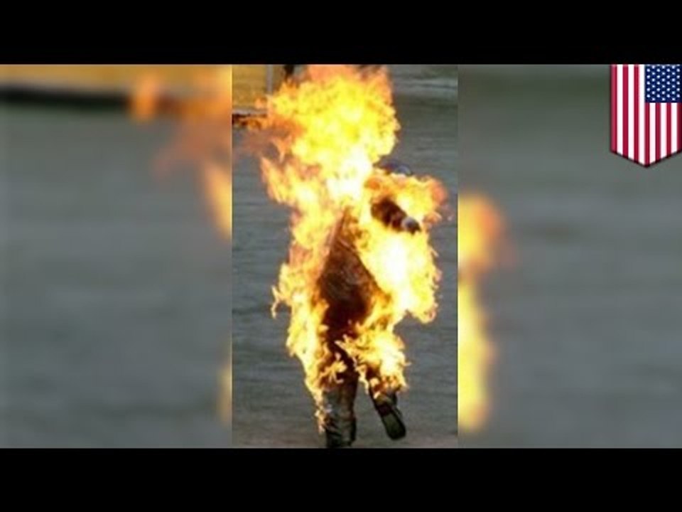 Hombre intenta cortarse las manos, cuello e incluso prenderse fuego en fallido intento de suicidio