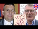 Hospital en Gales trasplanto riñones infectados con gusanos a dos pacientes, mueren semanas después