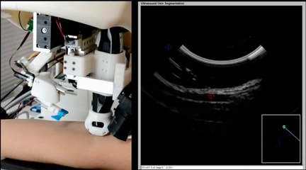 VenousPro : un robot infirmier étonnant
