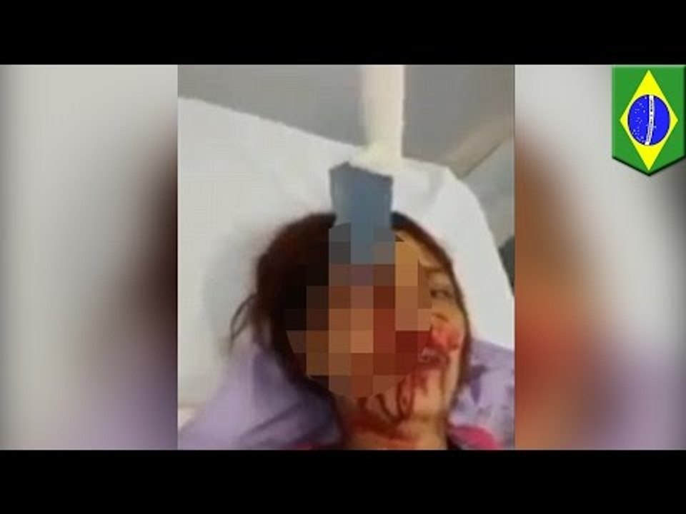 Mujer brasileña sobrevive cuando su ex novio le clavo un enorme cuchillo de cocina en la frente