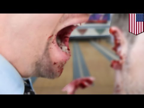 Pandillero le arranca de un mordisco la oreja a un hombre por culpa de una bebida derramada