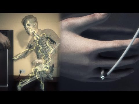 Hombre muere electrocutado en casa de sus suegros por culpa de su anillo de matrimonio