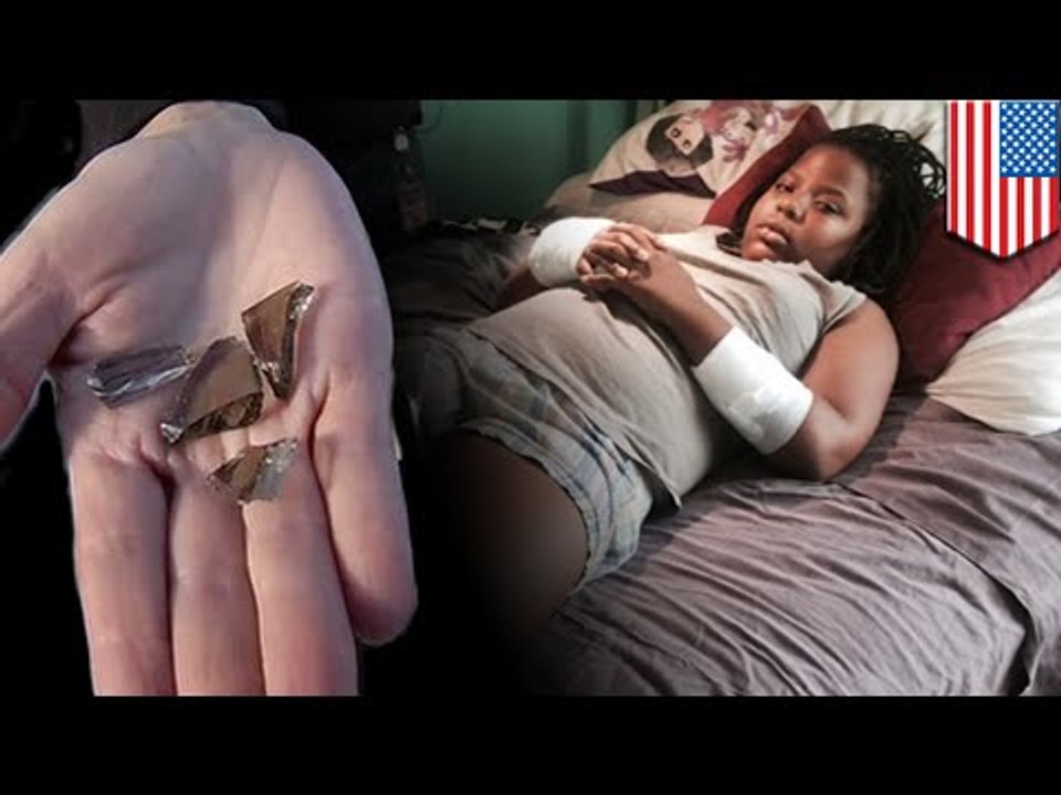 Niña necesita mas de 100 puntos de sutura al perder el control en trampolín y atravesar una ventana