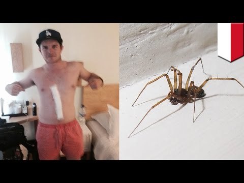 Turista australiano vivió 3 días con una araña incrustada bajo la piel