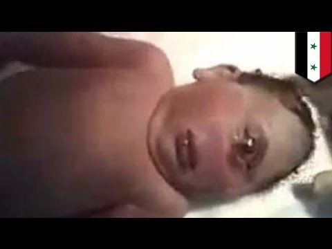 ISIS esta utilizando imágenes de bebes que nacieron con un solo ojo para reclutar yihadistas