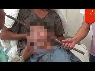 Download Video: Barra de metal atraviesa el cráneo de un hombre mientras hacia reparaciones en su hogar