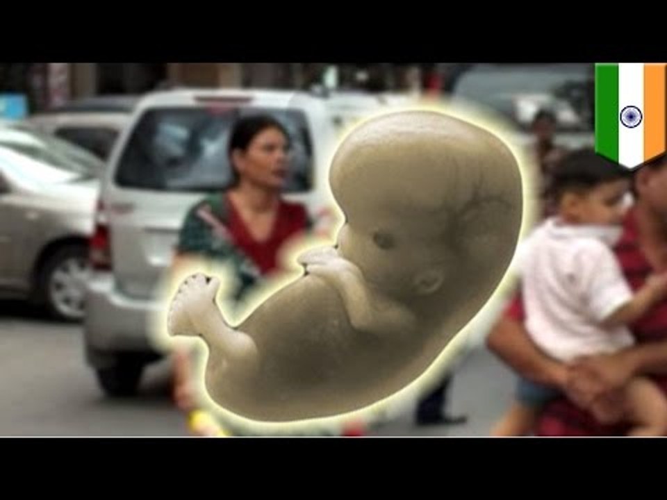 Esqueleto de un bebe es encontrado en el vientre de una mujer 38 años después de embarazo ectópico