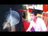 En extraños hechos un hombre en China termina con un cuchillo clavado en su cabeza