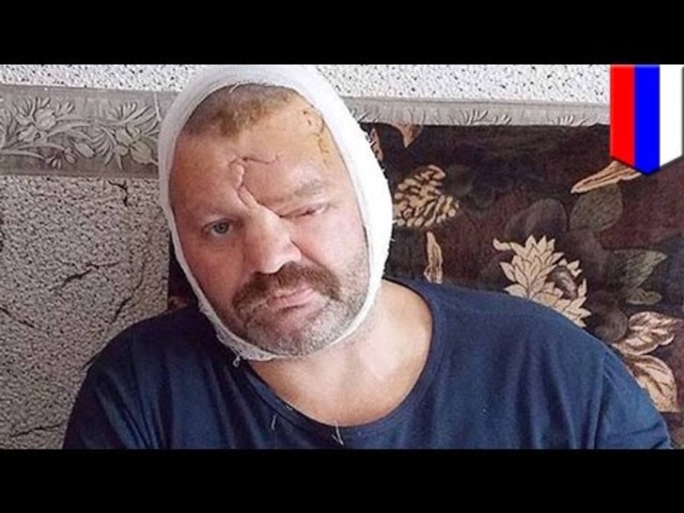 “Baby” de Justin Bieber le salva la vida a un pescador ruso que fue atacado por un oso