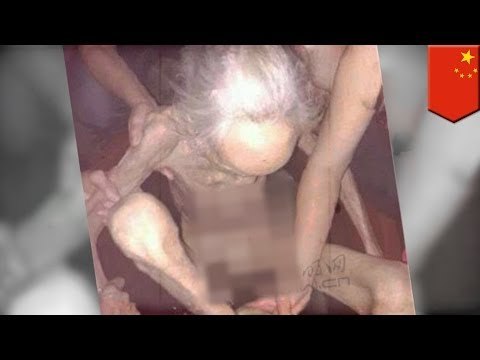 Anciana muere luego de ser encerrada por su propia hija, sin comida ni baño por un mes