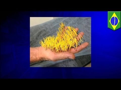 Hombre brasileño intenta espantar una zarigüeya , termina con 400 púas de puerco espín