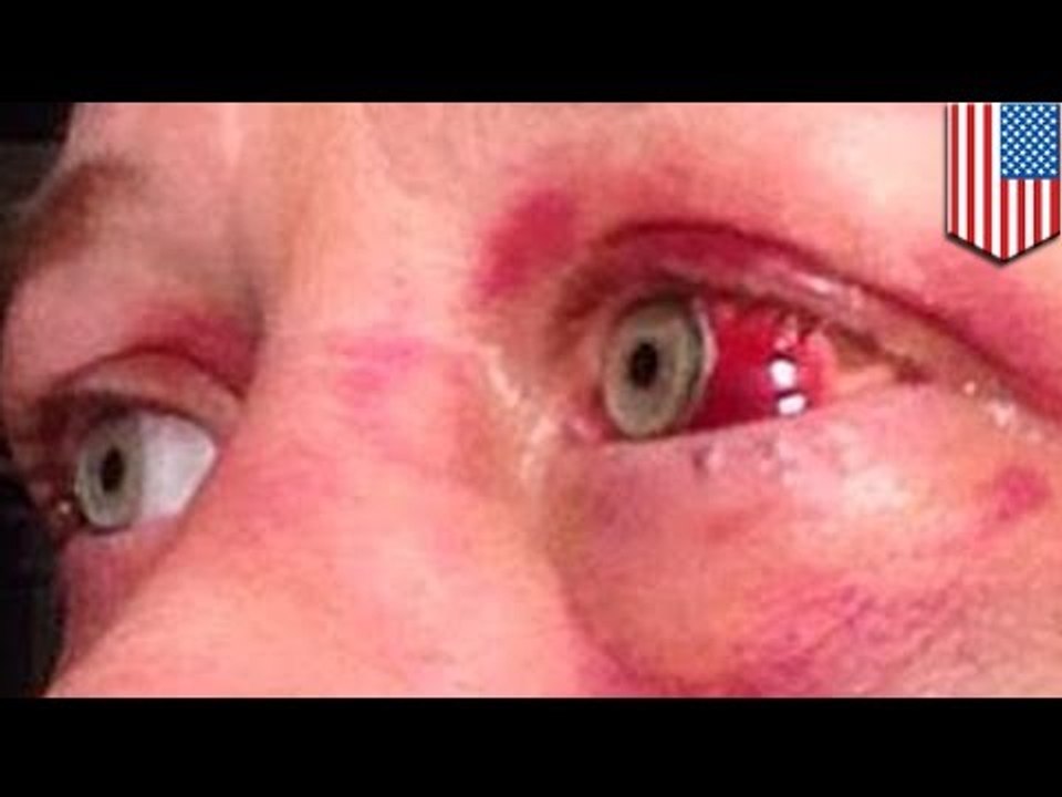 Mujer sube a Facebook impactantes fotos luego de ser golpeada por su novio hasta quedar inconsciente