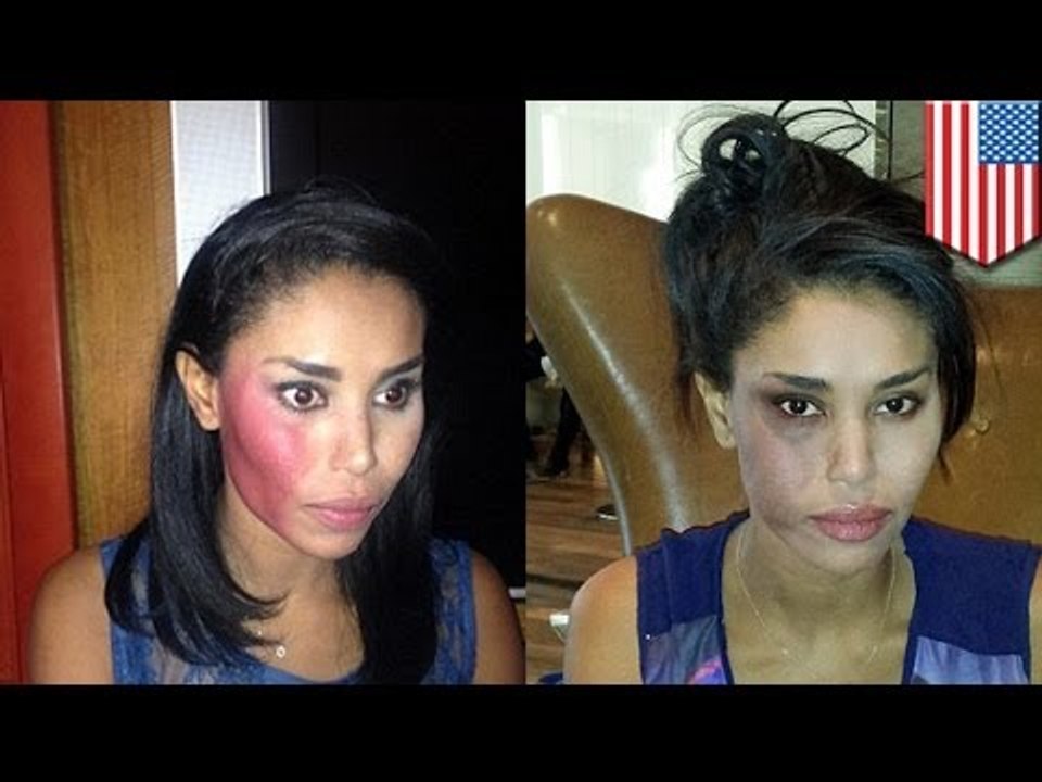 V. Stiviano, novia de Donald Sterling, es golpeada en un taxi en Nueva York, atacante arrestado